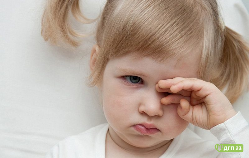 Краснота глаз у ребенка: что делать?